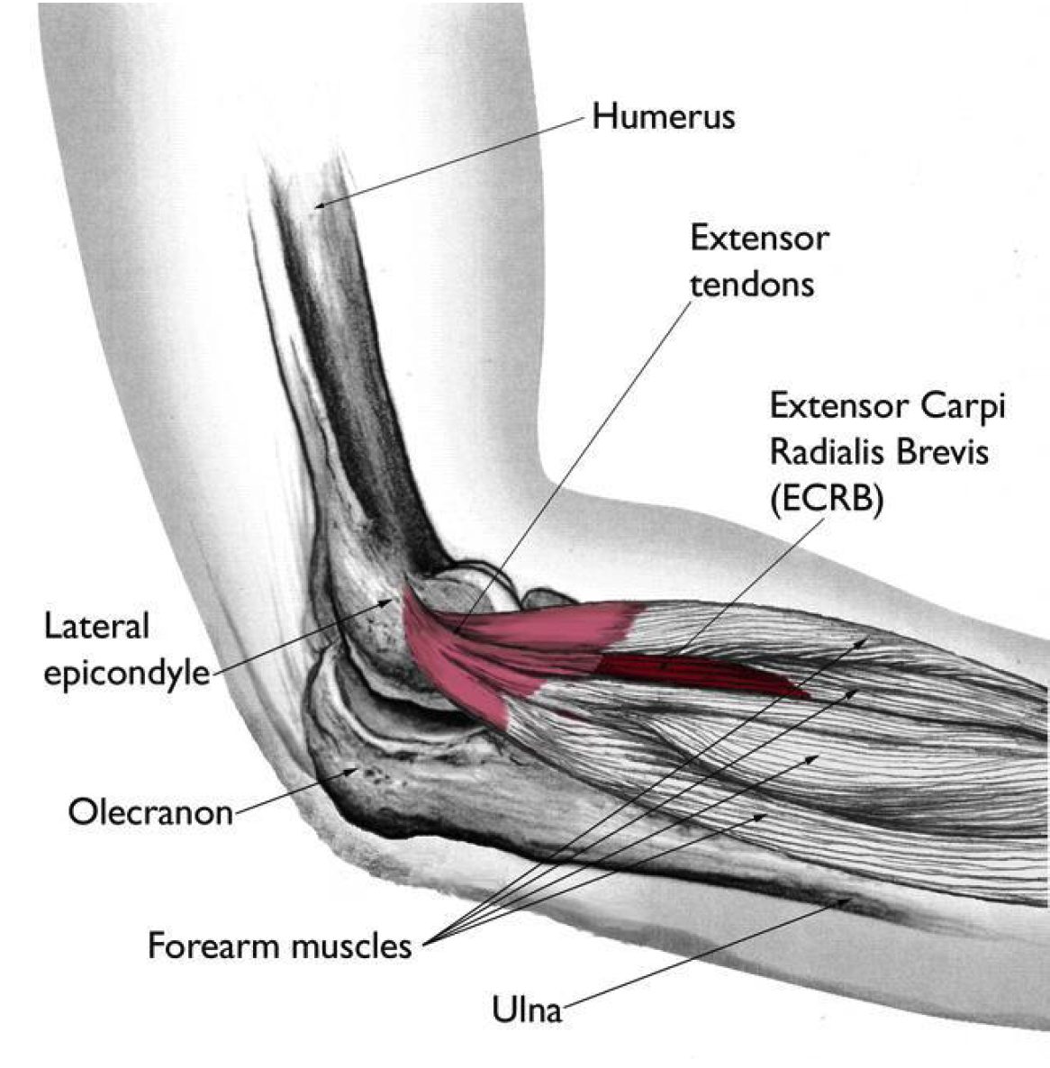tennis elbow tennis elbow